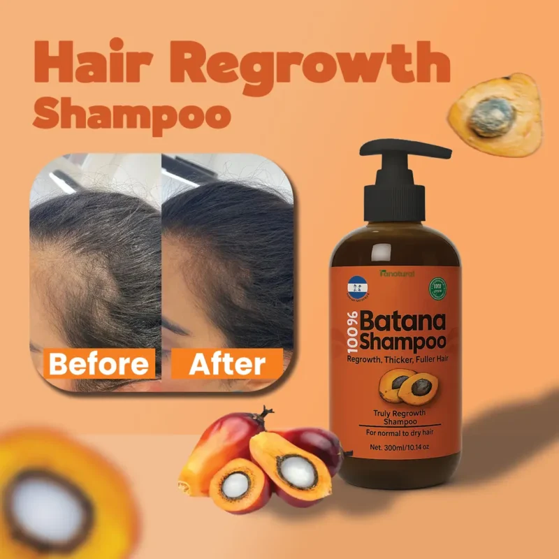 Batana oil for hair regrowth before and after Images